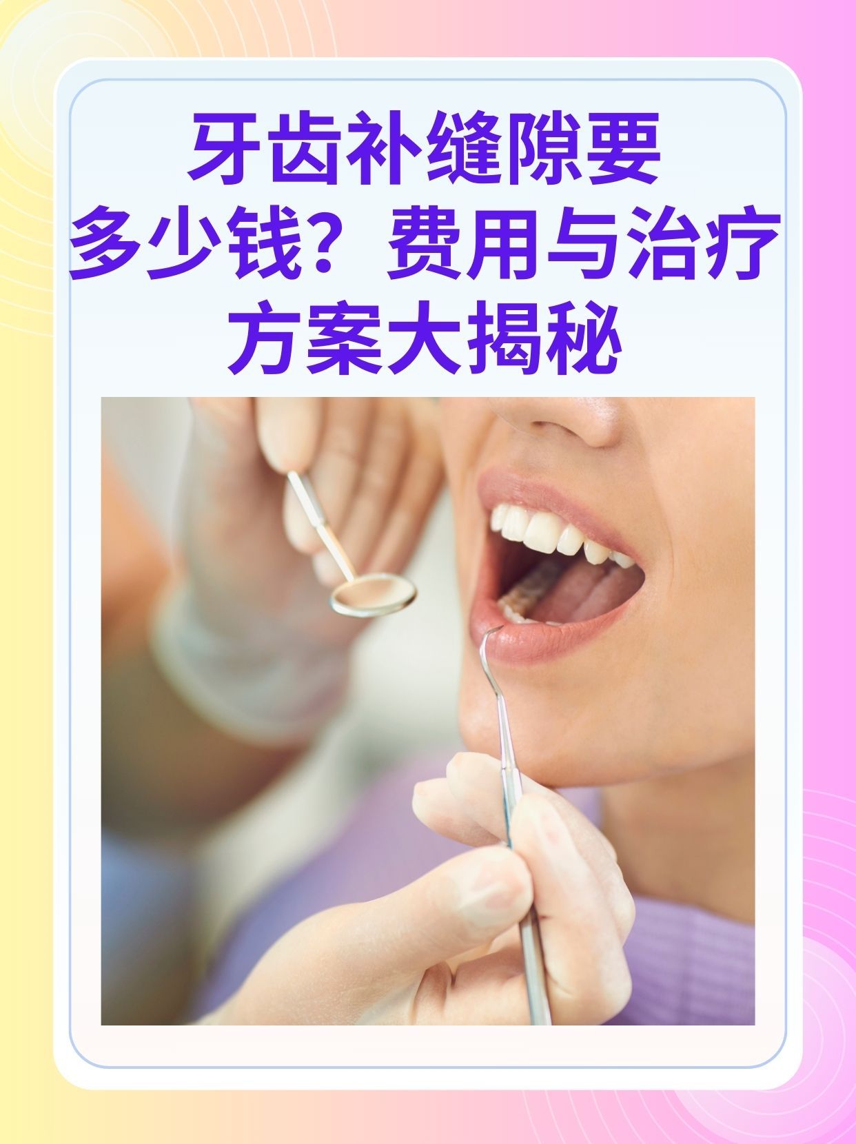 无锡补牙医保可以报销吗(补牙医保可以报销吗 哪些可以报销呢)